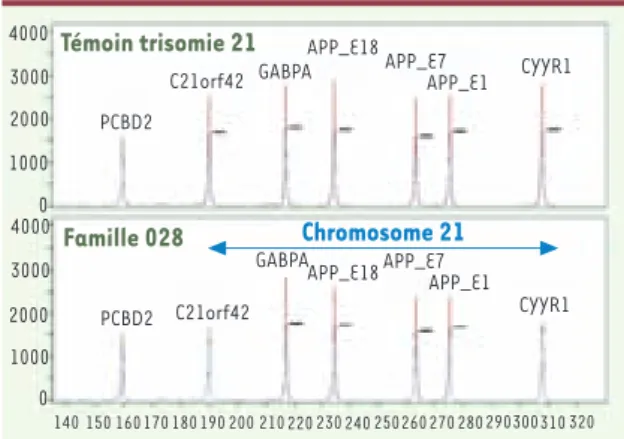 Figure 1. Analyse par QMPSF du dosage génique chez un sujet  trisomique et un patient de la famille 028