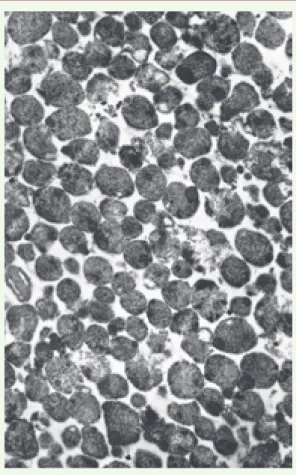 Figure 1. Lysosomes purifiés provenant de foie de rat (x 10 400). 