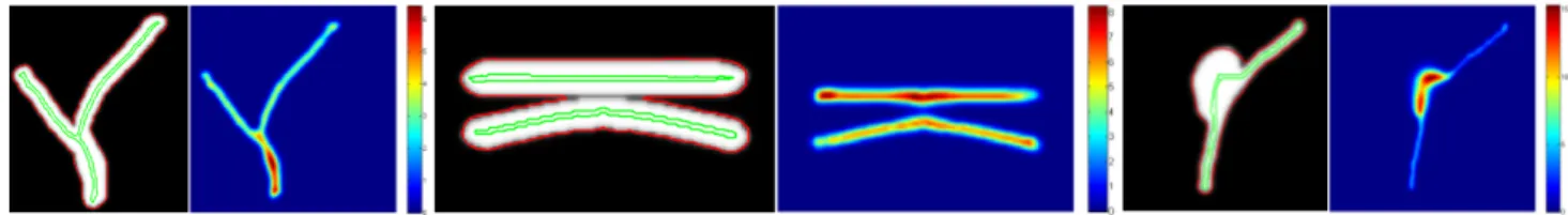 Figure 3. Segmentation results on synthetic images showing the initial image with the segmentation (red) and the centerline (green) overlaid, and the corresponding radius map