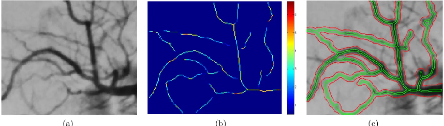 Figure 4. Results on 2D medical images with GVF-based initialization. (a) Original image