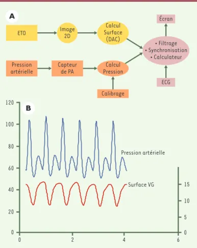 Figure  1. Reconstruction  off-line des  boucles  pression-surface  du  ventricule gauche