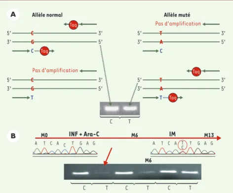 Figure 2. Détection de la mutation T315I par PCR spécifique d’allèle (PCR-ASO). A. Principe de la PCR-ASO