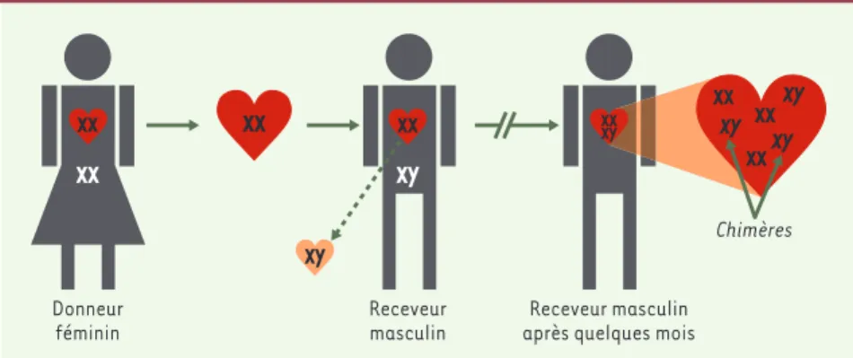Figure  2. Mise  en  évidence  de  chimères  lors  de  la  transplantation  d’un  cœur  féminin  chez  un receveur masculin