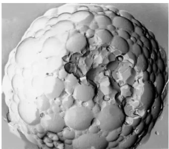 Figure 1.8. Vésicules lipidiques de DepoFoam ® . Reproduit de (Murry &amp; Blaney 2000) avec  permission de Pacira Pharmaceuticals Inc (© 1996, 2009)