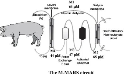 Figure 1.   The modified molecular adsorbent recirculating system (M-MARS) set-up. Haemofiltration/haemodialysis  unit clamped off