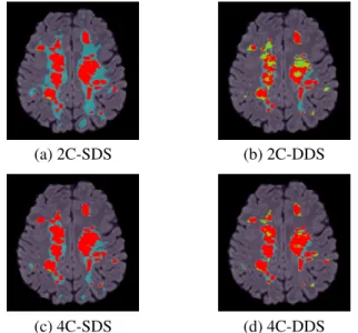 Fig. 1. Comparison of MS lesion classification methods, as referred in Table 1. Classification image is superimposed on FLAIR MRI