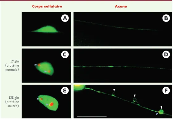 Figure 5. Modèle de dysfonctionnement neuronal sans mort cellulaire chez C. elegans. Anomalies induites par l’ex- l’ex-pression de la partie amino-terminale de la huntingtine normale (19 glutamines [gln], C,  D) ou mutée (128  glu-tamines, E, F) fusionnée 