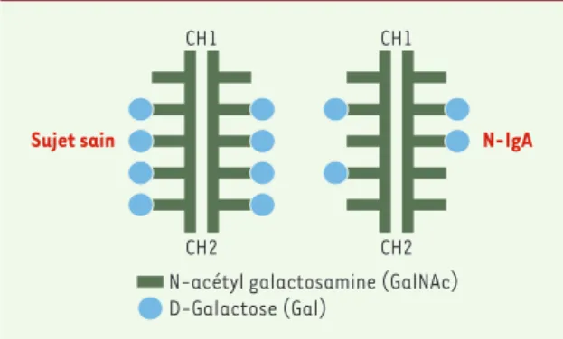Figure 2. Anomalies des O-glycosides de la région charnière des IgA1  chez  les  patients  présentant  une  néphropathie  à  IgA  (N-IgA) (d’après  [16])