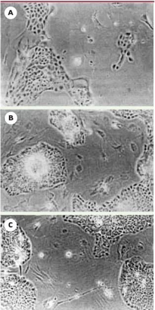 Figure 3. Rôle des fibroblastes dans la culture des kératinocytes.