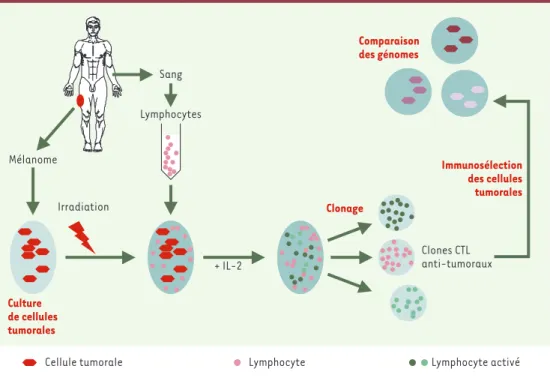 Figure 1. Obtention de clones CTL antitumoraux autologues. L’expérience de clonage des lymphocytes T spécifiques des antigènes tumoraux a consisté à cultiver des cellules tumorales provenant d’une biopsie, à les irradier, puis à les mélanger à des lymphocy