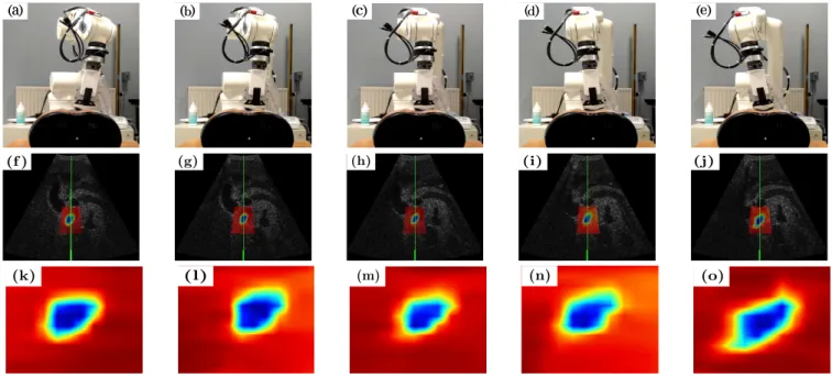 Fig. 7. Experiment with different probe orientations: (a)-(e) show the pictures with the probe oriented at different angles, from left to right the angles are θ 0 = − 10 ◦ , θ 1 = − 5 ◦ , θ 2 = 0 ◦ , θ 3 = 5 ◦ and θ 4 = 10 ◦ 