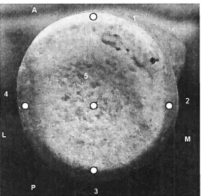 Figure X: Points taken at proximal surface of the radius, superior view.