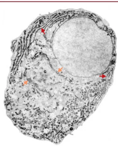 Figure 3. Détection de la prolactine dans une cellule glandulaire de l’anté-hypo- l’anté-hypo-physe de rat observée en microscopie électronique