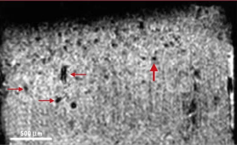 Figure 3. Image obtenue par l’analyse en microscopie-IRM d’échantillon de tis- tis-sus d’un patient atteint de maladie d’Alzheimer