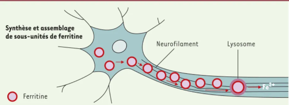 Figure 1. Modèle théorique d’un mécanisme lésionnel des neurones par l’accumulation de fer