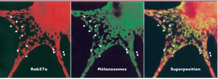 Figure 3. Rab27a (en rouge) et les mélanosomes (en vert) sont co-localisés (en jaune) dans les mélanocytes humains.