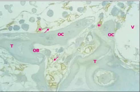 Figure 2. Localisation des fibres nerveuses dans la métaphyse de fémur de rat nouveau-né