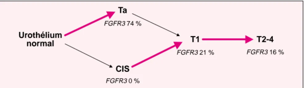 Figure 2. Mutations de FGFR3 et progression tumorale dans les carcinomes de vessie. Le schéma de progression tumorale indiqué se fonde sur des  évi-dences cliniques et moléculaires [12, 13]