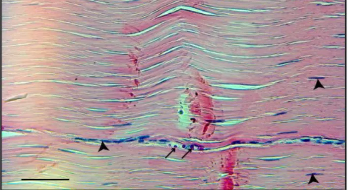 Figure 4 : Section longitudinale de tendon observée au microscope  Coloration : Hématoxyline Phloxine Safran, échelle : barre = 50 µm 