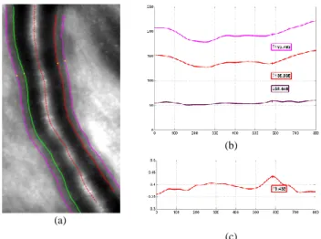 Figure  3.  Imaging  of  the  wall  of  an  arteriole  (between  arrows  in  the  magnification)  by  AO  flood  illumination  imaging (bar, 300µm)