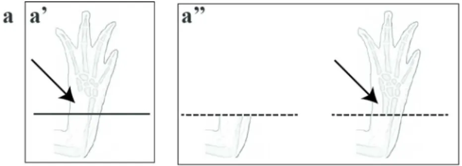 Figure 2:Schematic representation of bone extirpation and limb irradiation in Axolotl