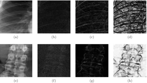 Figure 3: Estimation of the LNC-maps from analysis of noisy and denoised images. Top row: