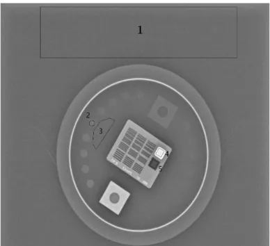 Figure 5: Standard PHD5000 phantom with annotated ROIs used to compute the following measures: SNR from region 1; CNR from regions 2 and 3; DYN from regions 4 and 5