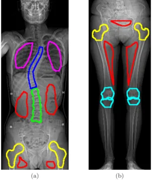 Figure 7: Examples of manually segmented regions used for computing anatomic ALV: red