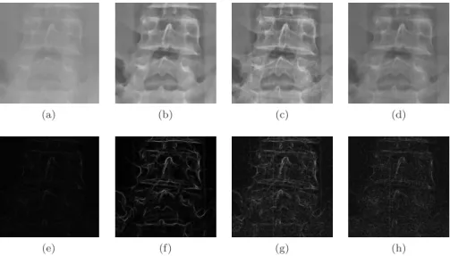 Figure 9: Visual comparison of vertebrae L4 and L5 in A 1 : top row = images and bottom row = related Sobel gradient magnitudes; columns from left to right = IN, DE, LNCE amd EOSE.