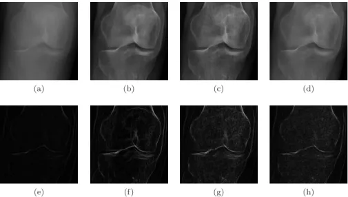 Figure 10: Visual comparison of knee in A 5 : top row = images and bottom row = related Sobel gradient magnitudes; columns from left to right = IN, DE, LNCE and EOSE.