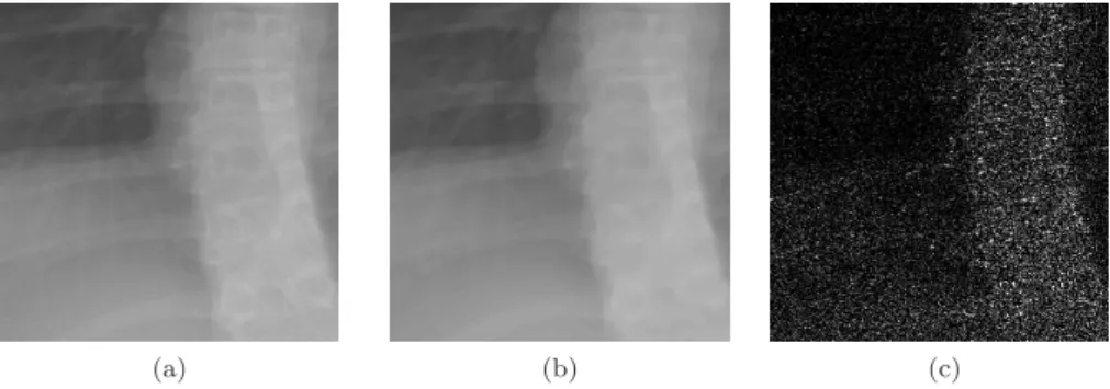 Figure 2: Zoom of XNLM filter output: (a) input image I ; (b) denoised image ˆ I; (c) absolute difference kI − Ik.ˆ
