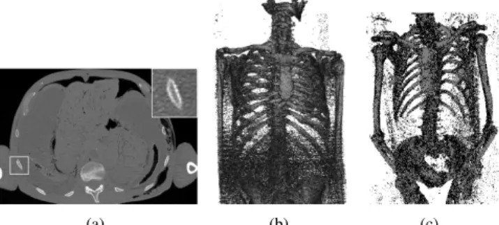 Fig. 1. Illustrations of the challenges in rib identification on a heterogeneous database of CT images: (a) Axial slice of the torso showing very thin ribs’ cortical cross-sections (see the inset zoom) with a typical thickness of 1.5 mm; (b) High noise lev