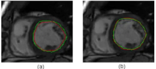 Fig. 2. Left: superposition of the first approximate contour (red) and the manual contour (green)