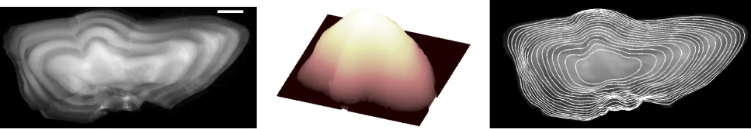 Fig. 3. Reconstruction of the series of growth shapes for the pollock (Pollachius pollachius) otolith image depicted above based on the gradient-based orientation field: image of the pollock otolith (left), reconstructed potential function U (middle), seri