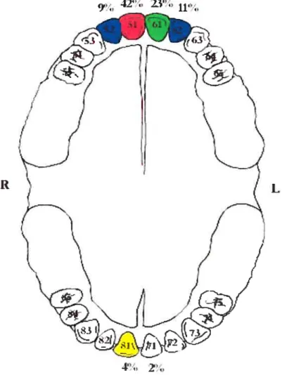 Figure 1: Distribution of trauma to pnmary dentition by site 42’. 23”., 11”..
