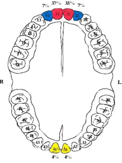 figure 2: Distribution of trauma to permanent dentition by site