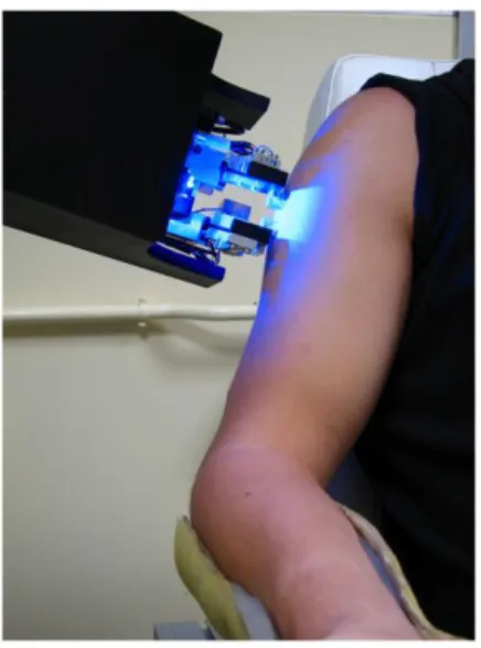 Fig. 1.  Testing device during in vivo test on the arm.  