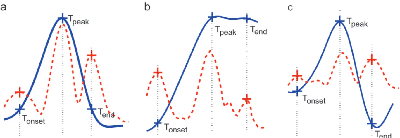 Fig. 2. Delineation results obtained for three different T wave morphologies. Solid blue line: estimated T waveform, dotted red line: corresponding curvature