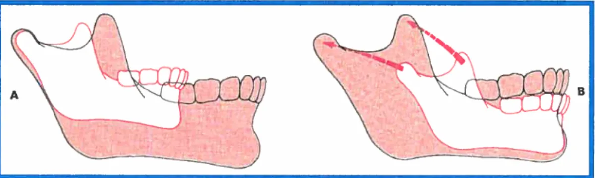 figure 4: A- croissance de la mandibtile avec point de référence le crône, le menton se déplace vers le bas et l’avant