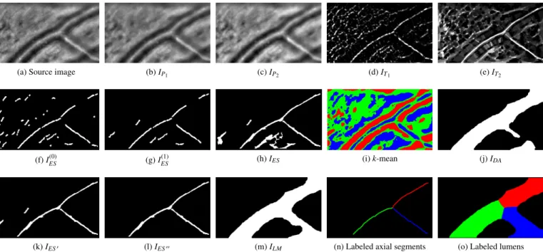 Figure 3: Steps for axial reflection detection: The source image (a) is pre-processed in two di ff erent ways (b,c)