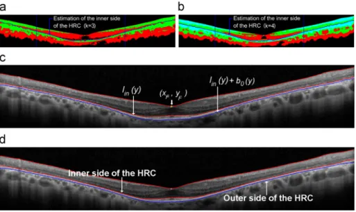 Fig. 12. HRC localization for RP subjects: (a) and (b) regularized classiﬁcation results with respectively k¼3 and k¼4, with, in dark blue, the estimated inner HRC boundary;