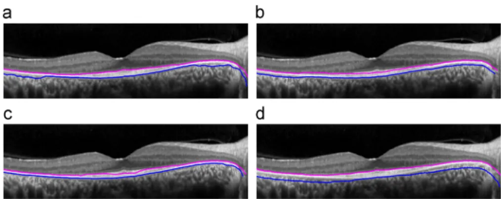 Fig. 4. Results with the twin snakes, for different parameter settings. (a) δ¼0.5, d 0 ¼12