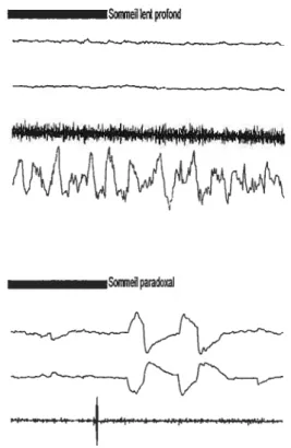 figure 3. Échantillons polysomnographiques pour chaque stade de sommeil. Pour chaque échantillon, les quatre dérivations correspondent respectivement à l’EOG gauche, 1’EOG droit, l’EMG sous-mentonnier et l’EEG au site central gauche
