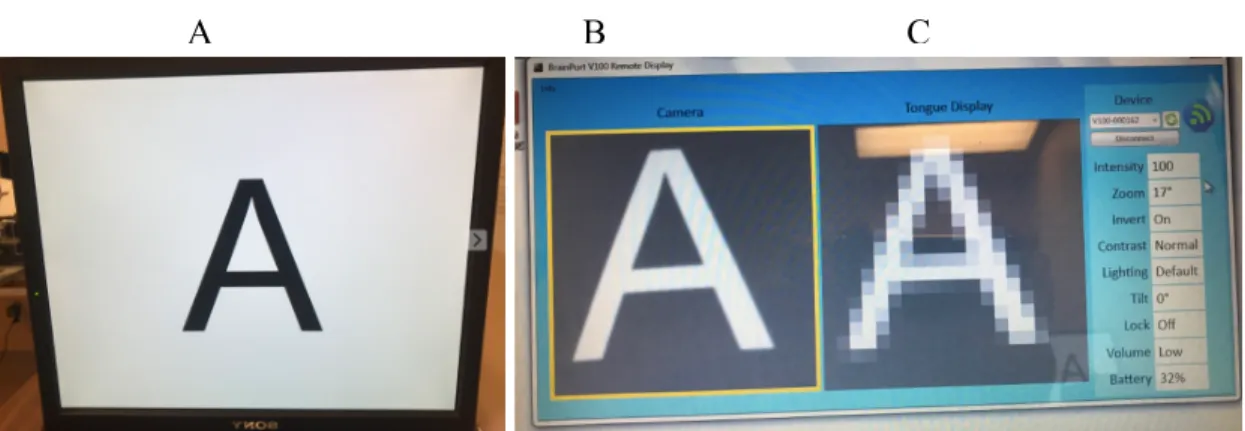 Figure 9: A) The letter A displayed on the computer screen (in front of the subject). B) This is  the display created by the vRemote software