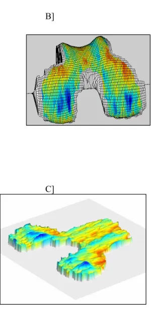 Figure 1. Cartilage quantitative evaluation of knee joint using magnetic resonance  imaging (MRI)