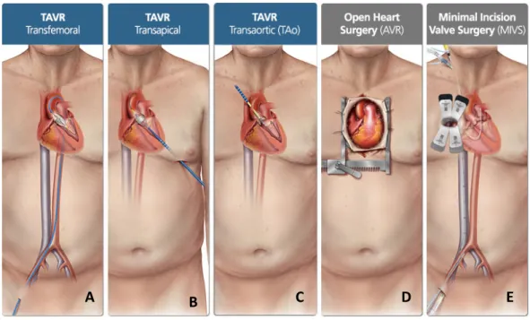 Figure 4: Quelques illustrations de RVA 