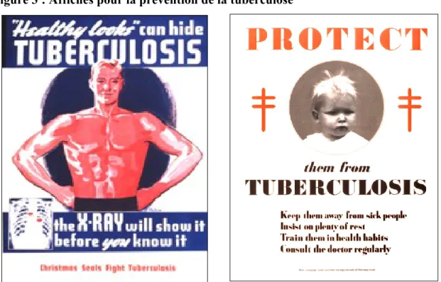 Figure 3 : Affiches pour la prévention de la tuberculose 14
