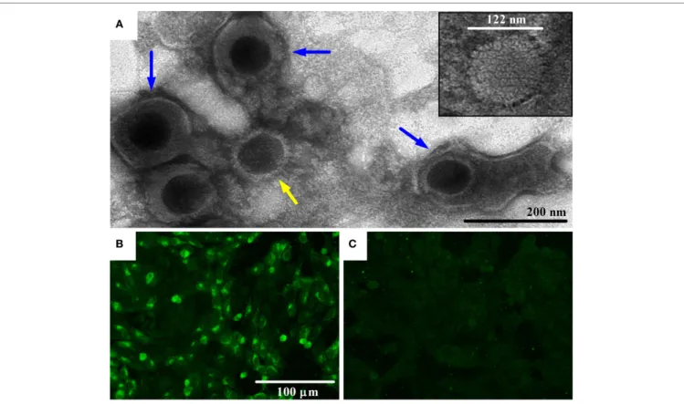 FigUre 1 | Transmission electron microscopy (TEM) image of bovine gammaherpesvirus 4 (BoHV-4)-FMV isolate and detection of its antigens by indirect  immunofluorescence assay (IFA)