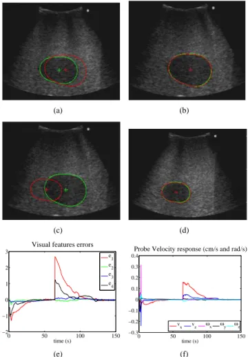 Fig. 7. Experimental setup: (left) medical robot equipped with an US probe transducer - (middle) interaction with an US phantom - (right) interaction with a lamb kidney immersed in a water-filled tank