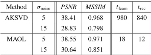 Table 2 : Compressive Sensing MRI volume reconstruction from noiseless radial sampled measurements with an  under-sampling rate of 20%